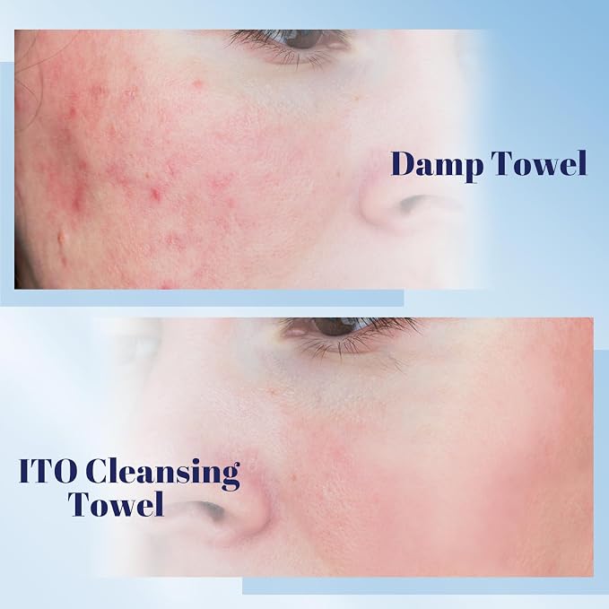 ITO Disposable Face Towel, Ultra-Soft 1-Second Quick-Dry Face Towels, Gentle - Image 5