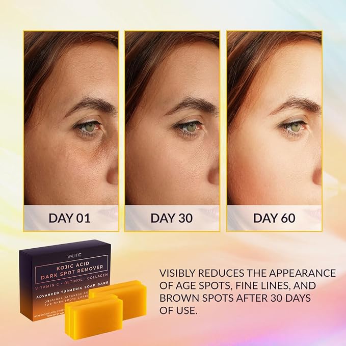 Valitic Kojic Acid Dark Spot Remover Soap Bar - Image 2